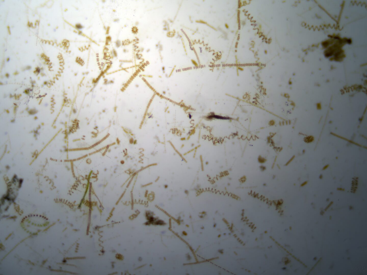 plankton image from microscope