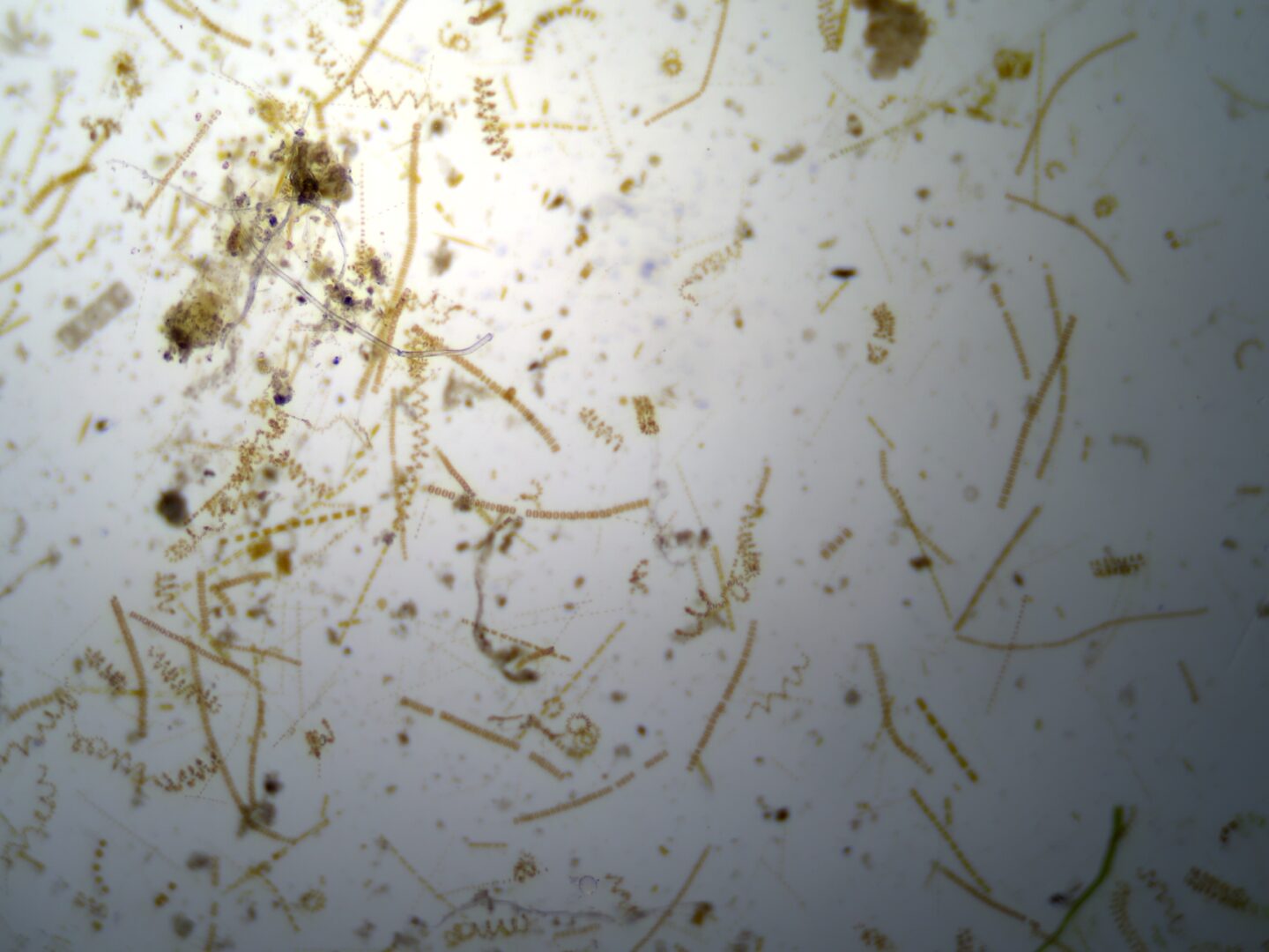 plankton image from microscope
