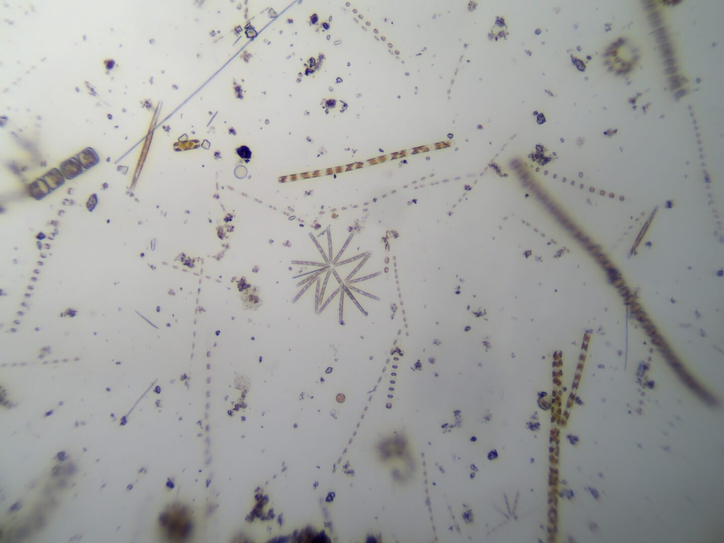 plankton image from microscope
