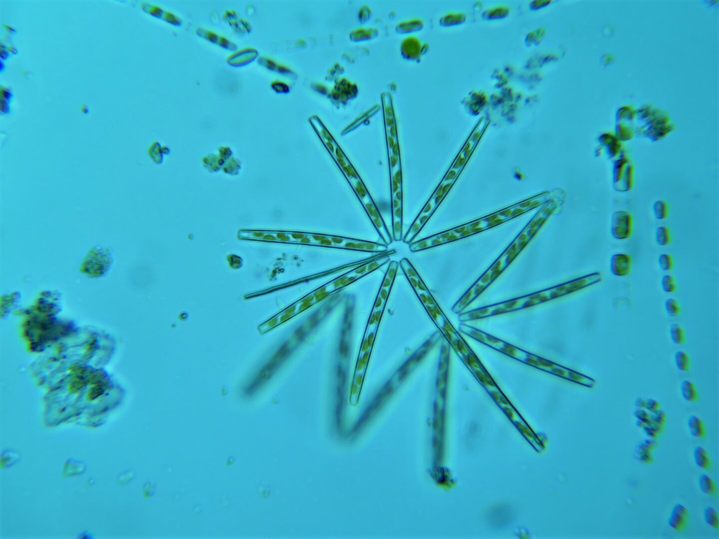plankton image from microscope at Hudson River Park