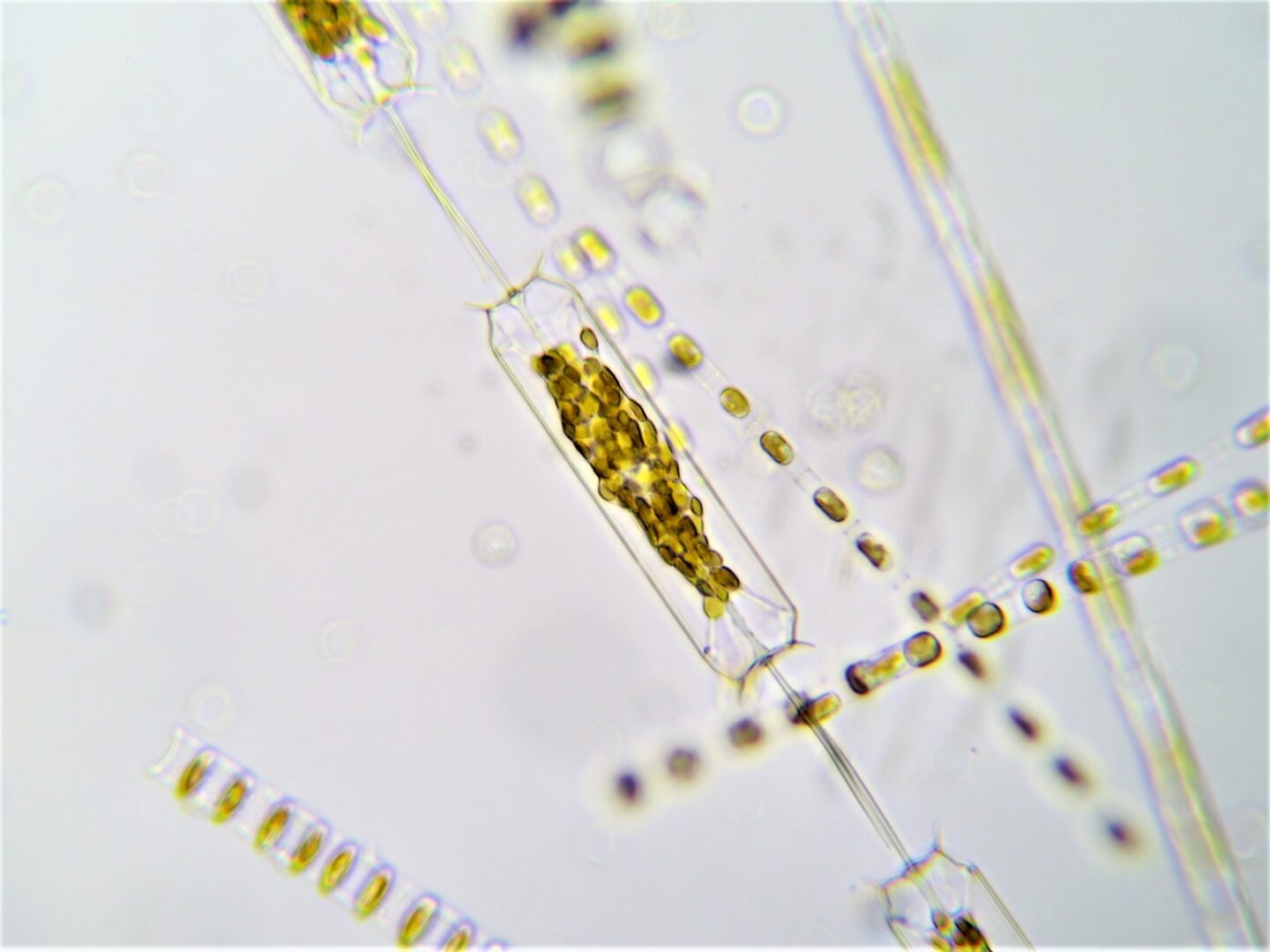 plankton image from microscope