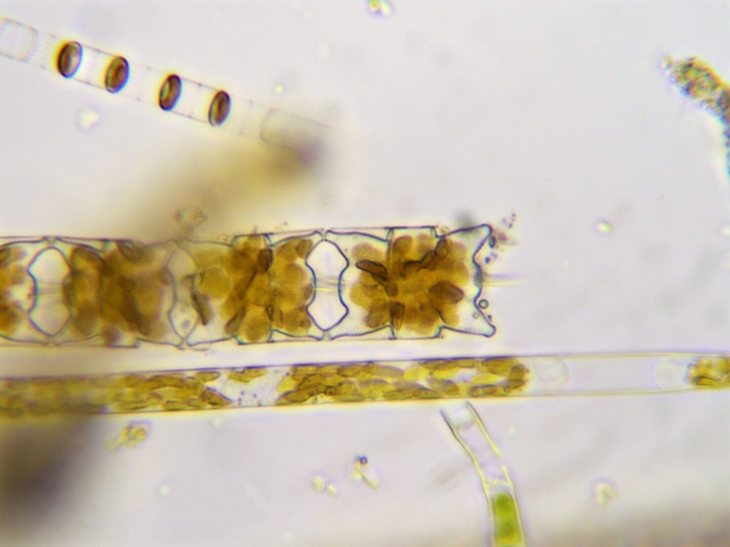 plankton image from microscope