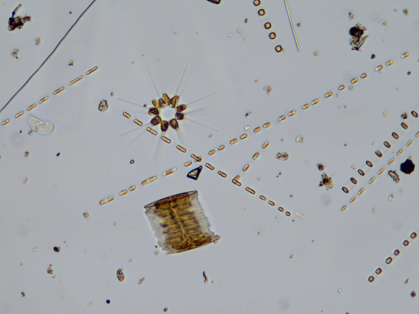Mixed phytoplankton, including asterionellopsis spp, skeletonema spp, and bascillaria spp