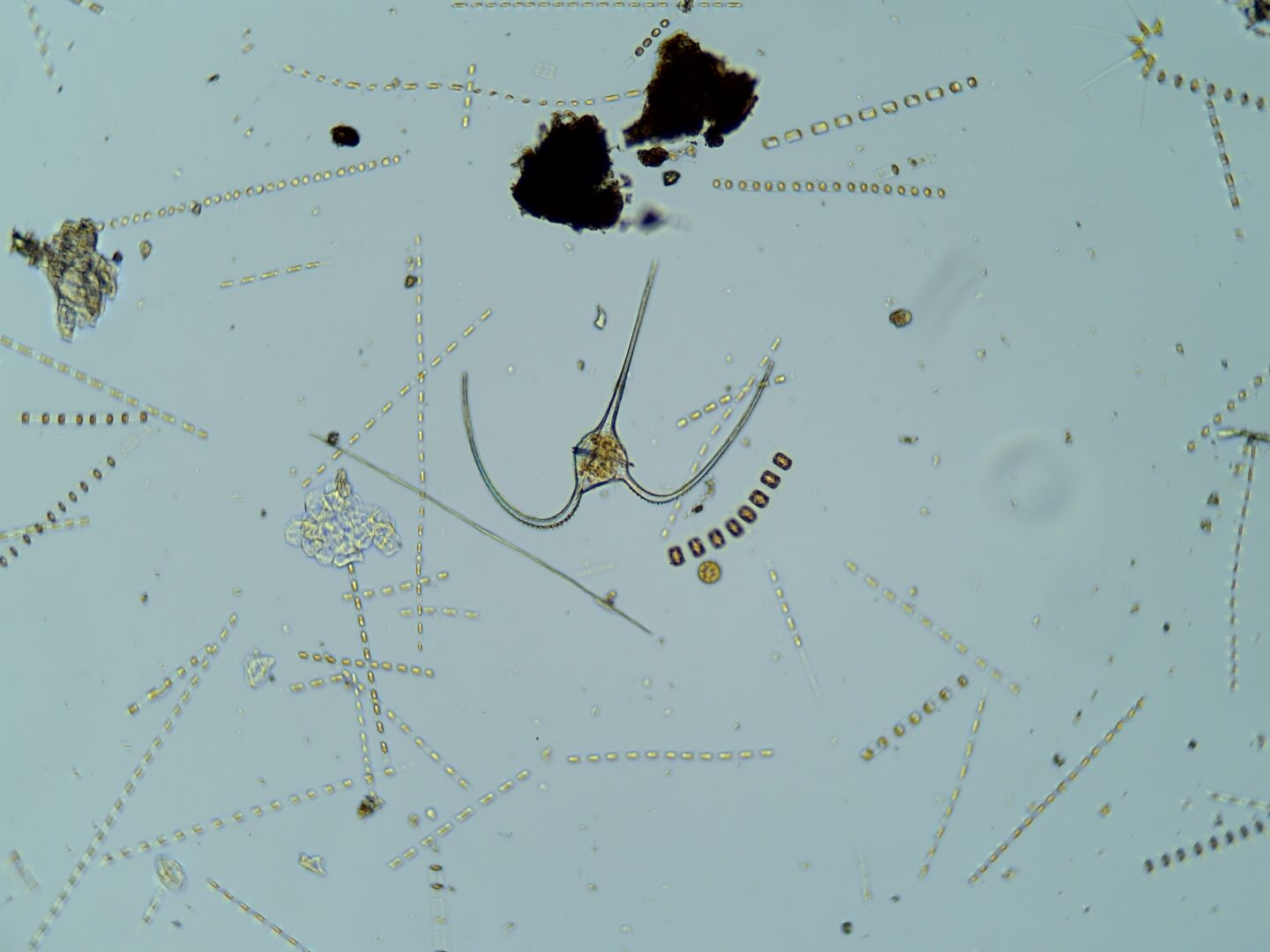 Mixed phytoplankton sample including tripos dinoflagellate, skeletonema spp, thallassiosira spp