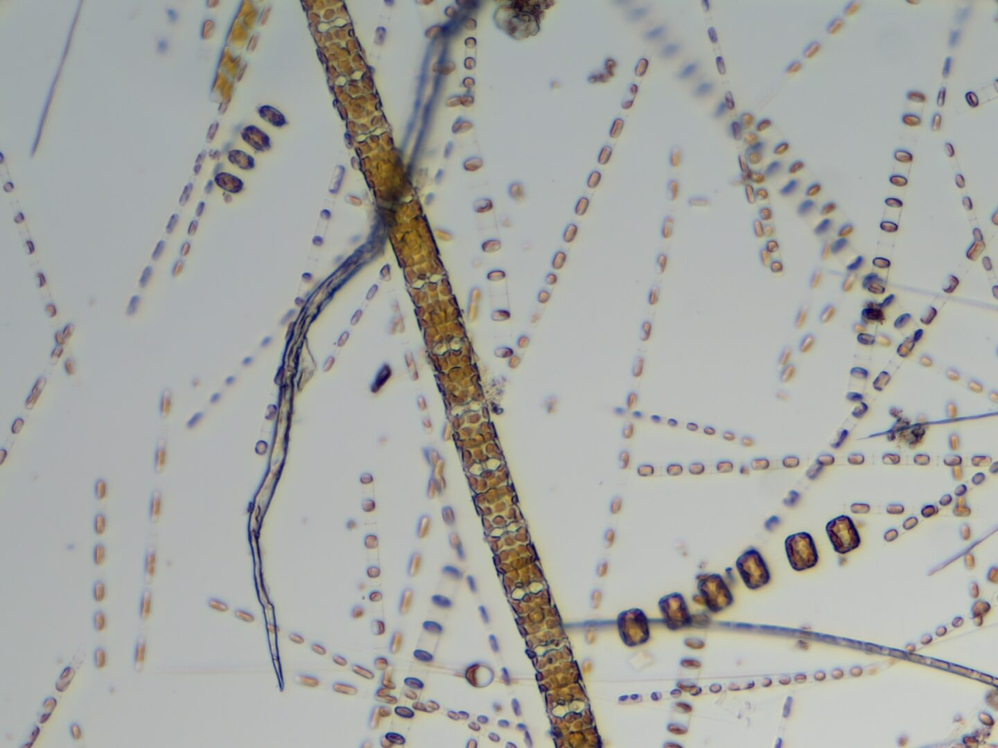 Mixed sample, ft. odontella colony, thalassiosira