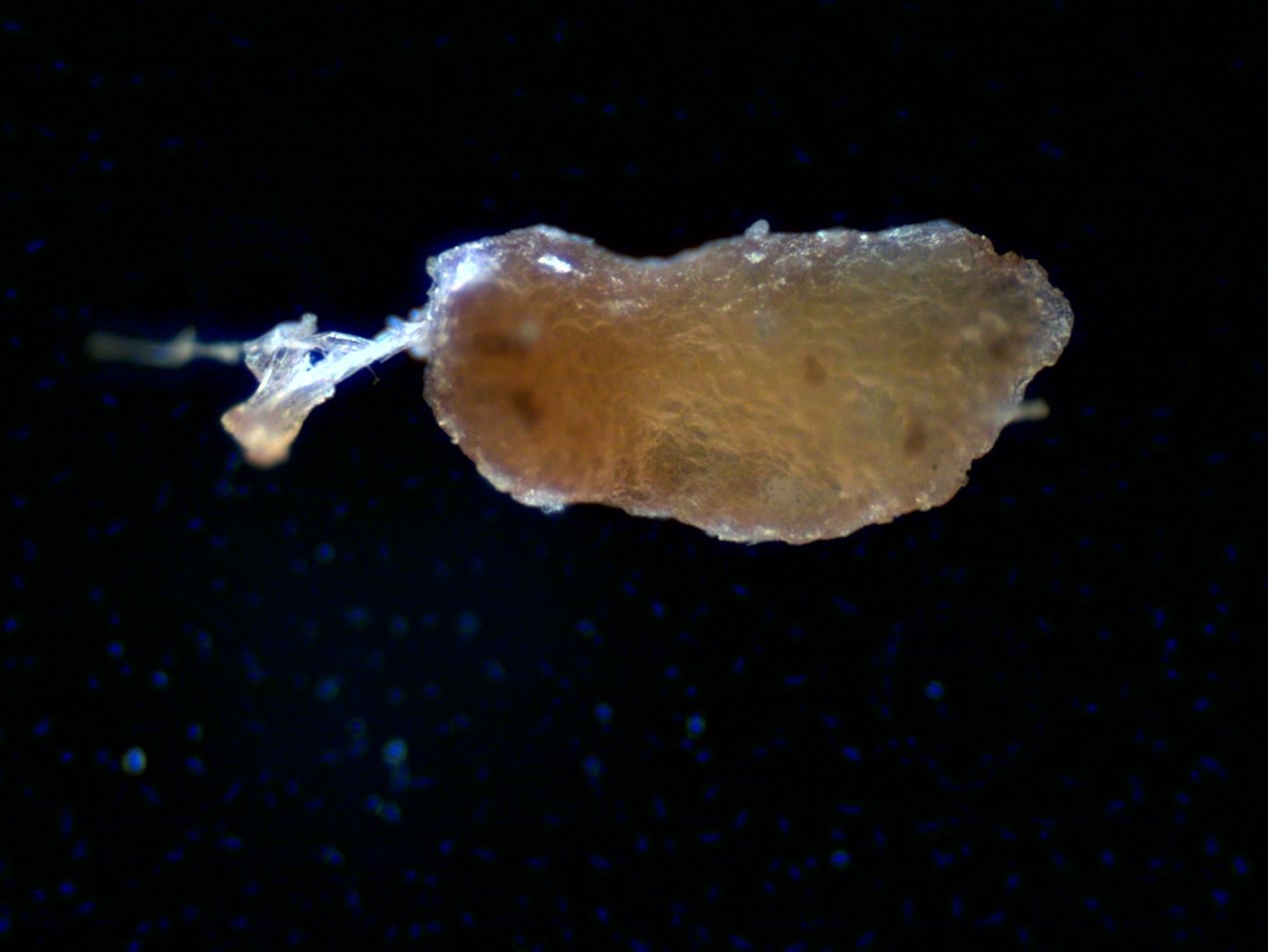 Microscope image of a microplastic found in the Hudson River